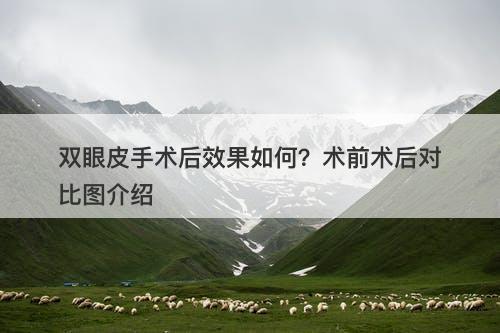 双眼皮手术后效果如何？术前术后对比图介绍