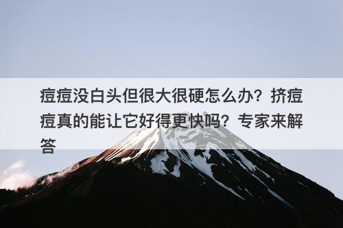 痘痘没白头但很大很硬怎么办？挤痘痘真的能让它好得更快吗？专家来解答