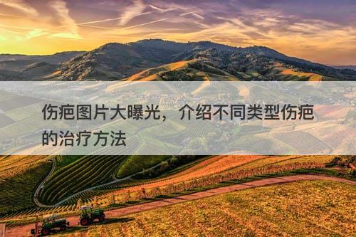 伤疤图片大曝光，介绍不同类型伤疤的治疗方法