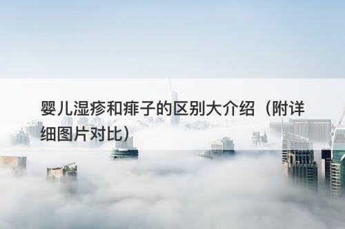 婴儿湿疹和痱子的区别大介绍（附详细图片对比）