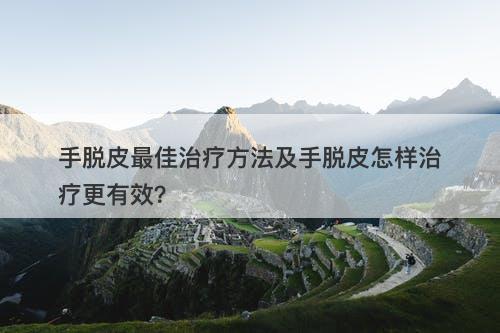 手脱皮最佳治疗方法及手脱皮怎样治疗更有效？